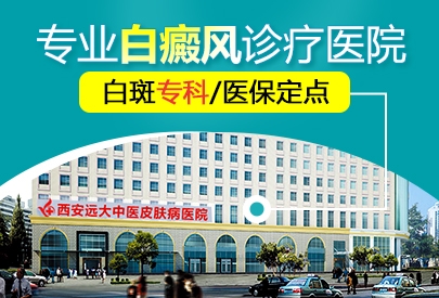 西安远大白癜风医院